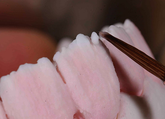 Prothèses dentaires