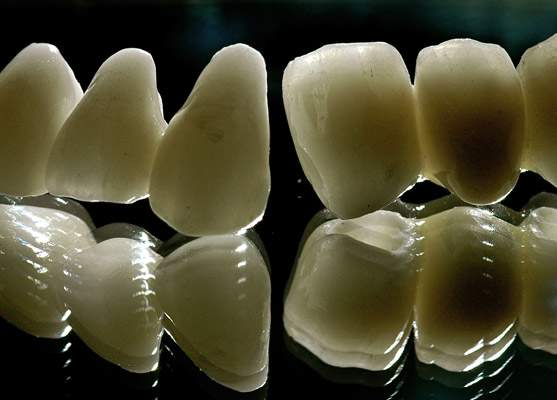 Prothèses dentaires